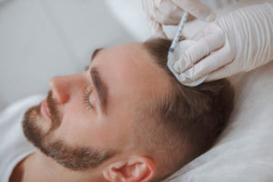 does prp for hair loss work