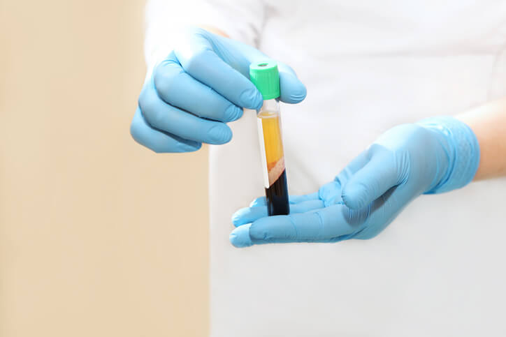 precautions after prp injection