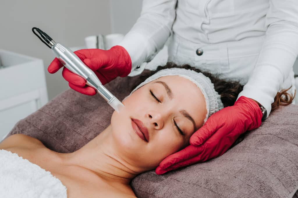 Woman getting microneedling treatment